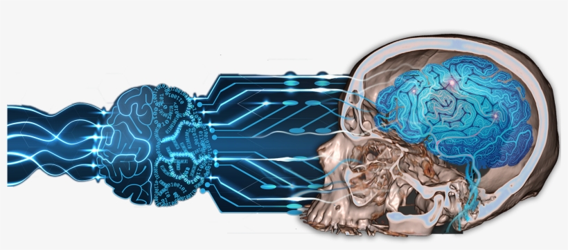 Cloud-based Artificial Intelligence For Medical Imaging - Current Developments In Stroke: Understanding Stroke, transparent png #967740