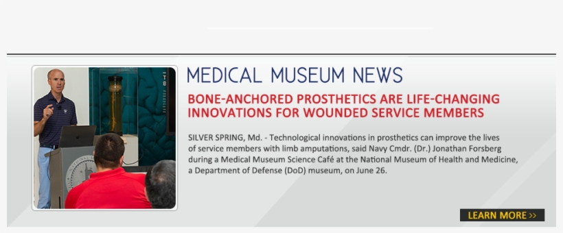 Bone Anchored Prosthetics Are Life Changing Innovations - Tread, transparent png #9645592