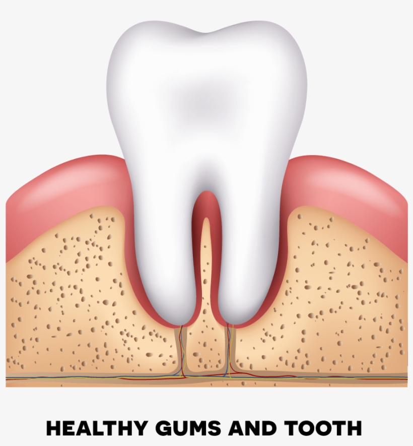 Healthy Gums - Periodontal Disease, transparent png #9649946