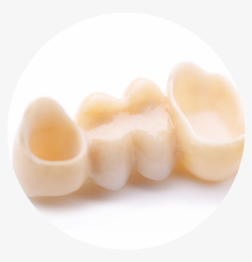 Crowns - Dessert, transparent png #9649951