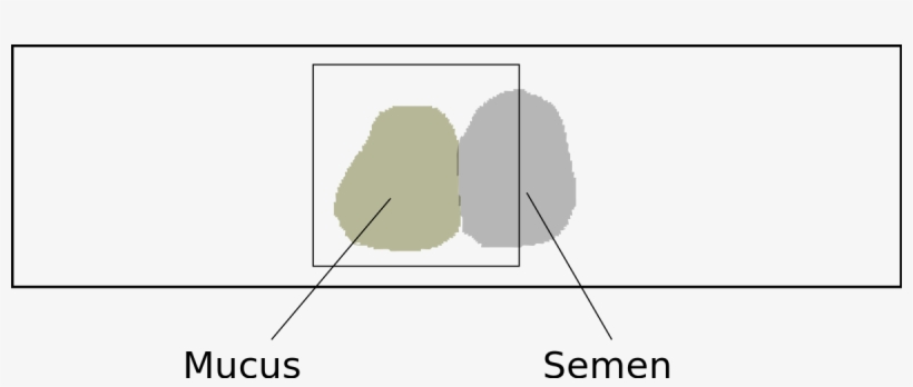 Miller Kurzrok Test, transparent png #9655170