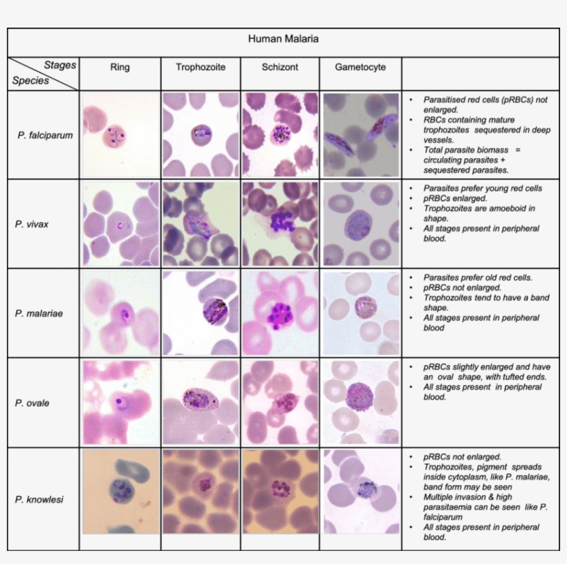 Download Scientific Diagram - Labeled Malaria Blood Smear, transparent png #9693330