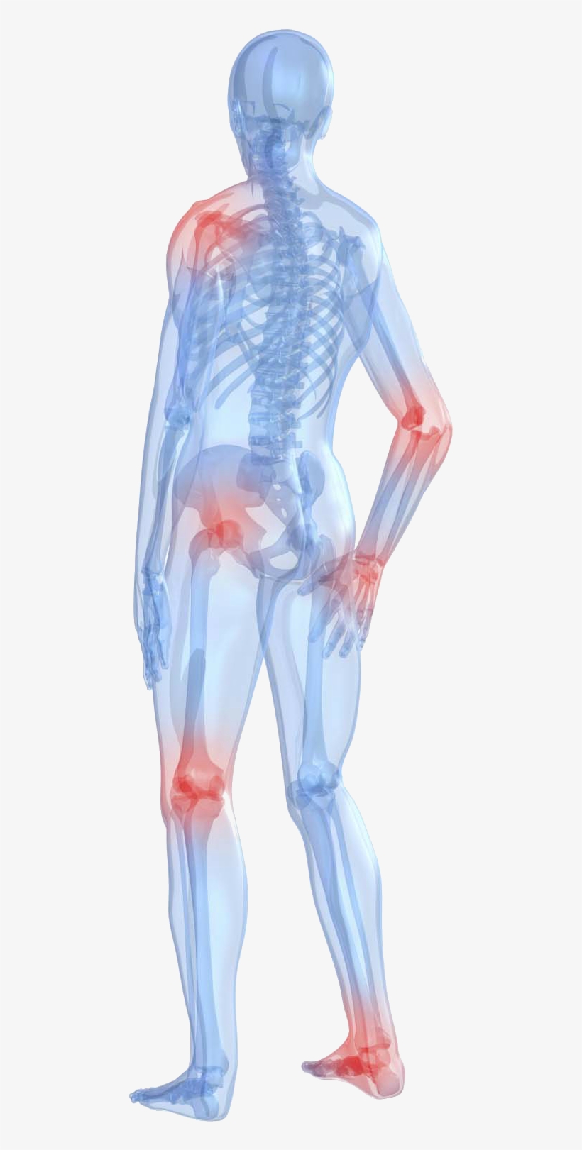 Me First Living Premium Standardized Turmeric Curcumin - Does Rheumatoid Arthritis Hurt, transparent png #9695332