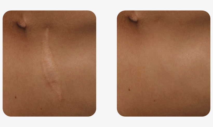 Scars - Wood, transparent png #9703034