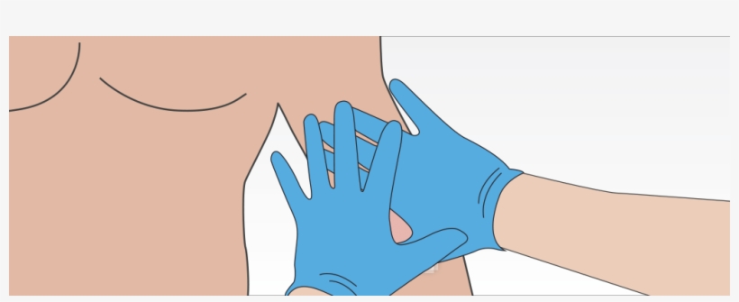 At The End Of Three Minutes, Apply A Pressure Dressing - Illustration, transparent png #9714175