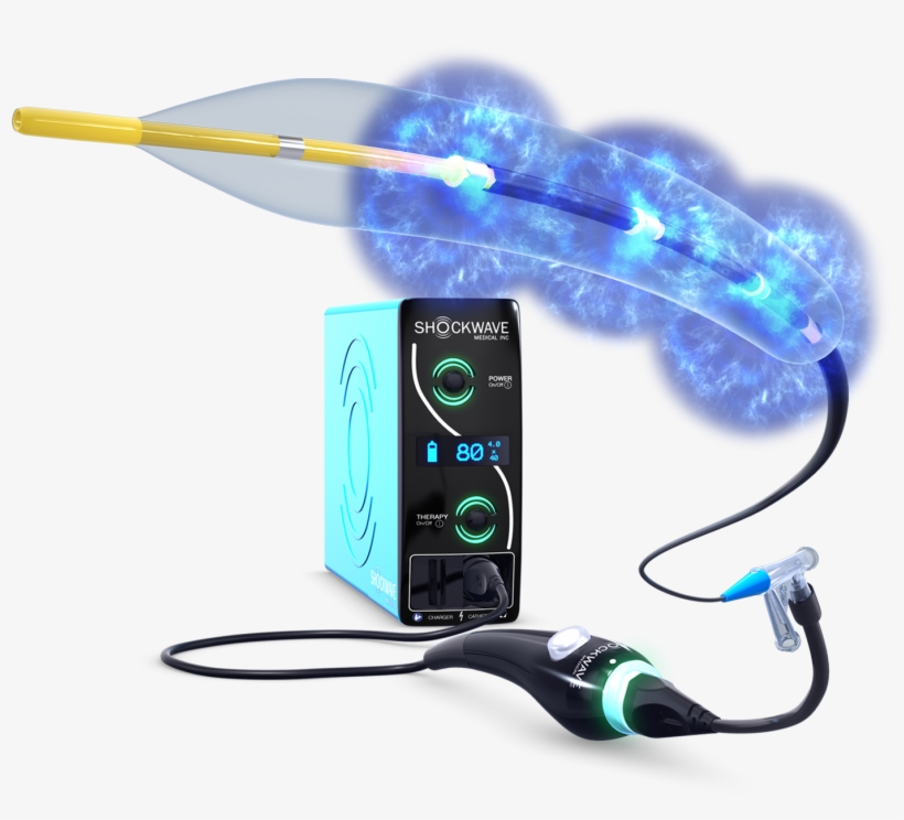 Shockwave Medical's Novel Intravascular Lithotripsy - Cable, transparent png #9768228
