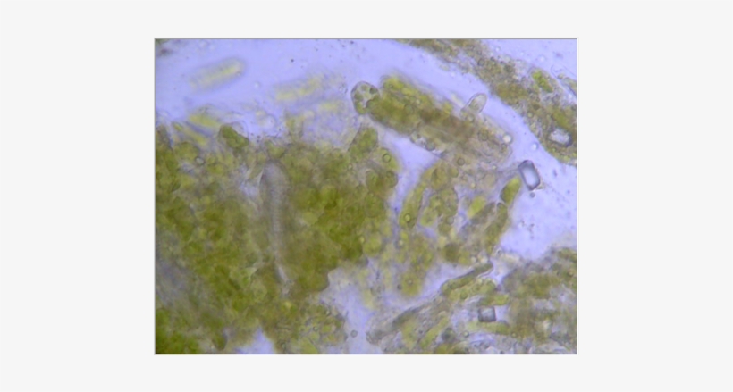 Bradford Pear Leaf - Chlorophyta, transparent png #980206
