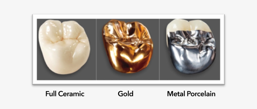 Crowns - Bruxzir Crown, transparent png #983354