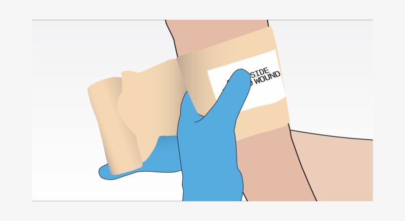 The Pressure Dressing - Junctional Rhythm, transparent png #987014
