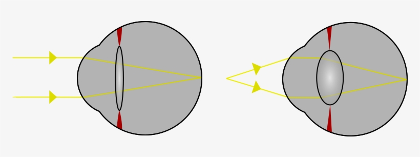 Focus In An Eye - Eye Lens Accommodation, transparent png #988488