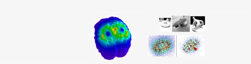 Tms- Coils And Simulated Magnetic Field - Circle, transparent png #9810585