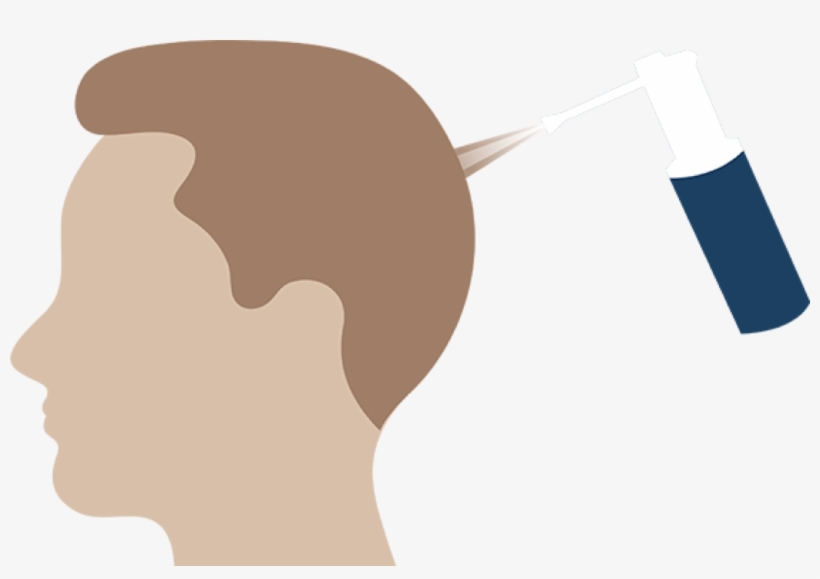 Hassle-free Process -, transparent png #9863978