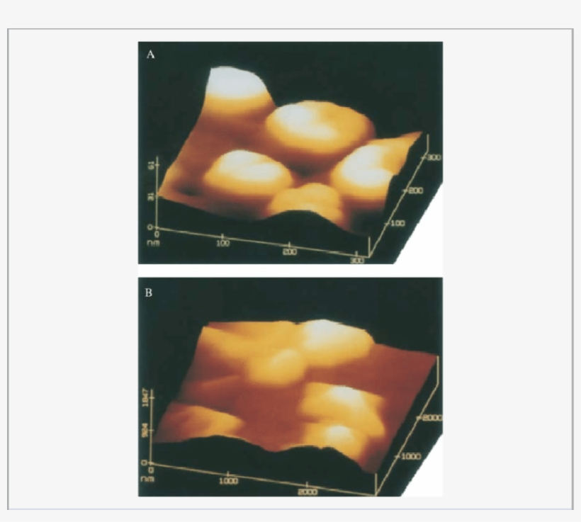 Afm Images Of Ha And Cppd Crystals From A Patient With - Calcium Pyrophosphate Dihydrate Crystal Deposition, transparent png #991390