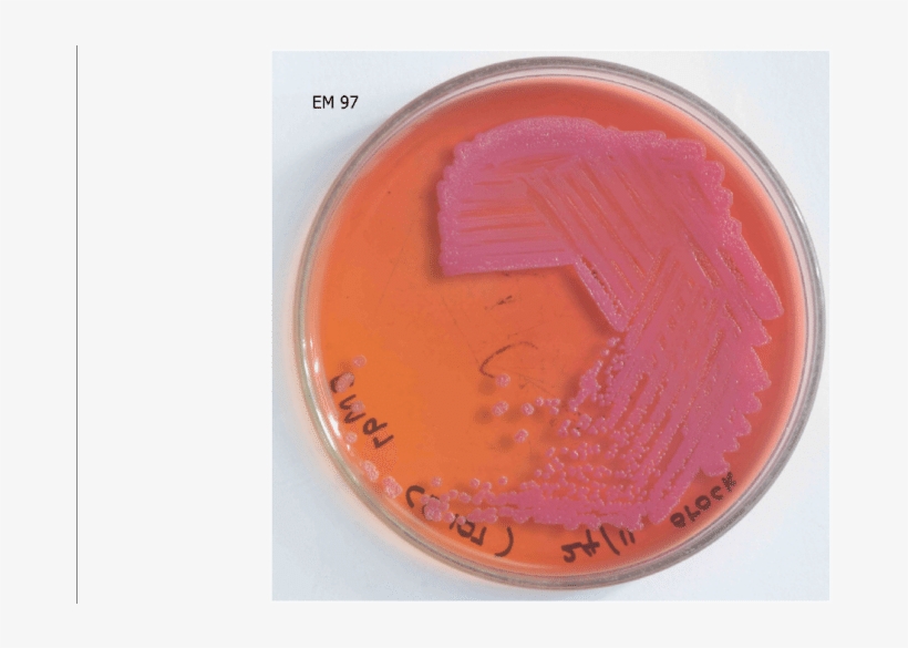 Pseudomallei Cultured In Macconkey Agar - Coin, transparent png #9908589