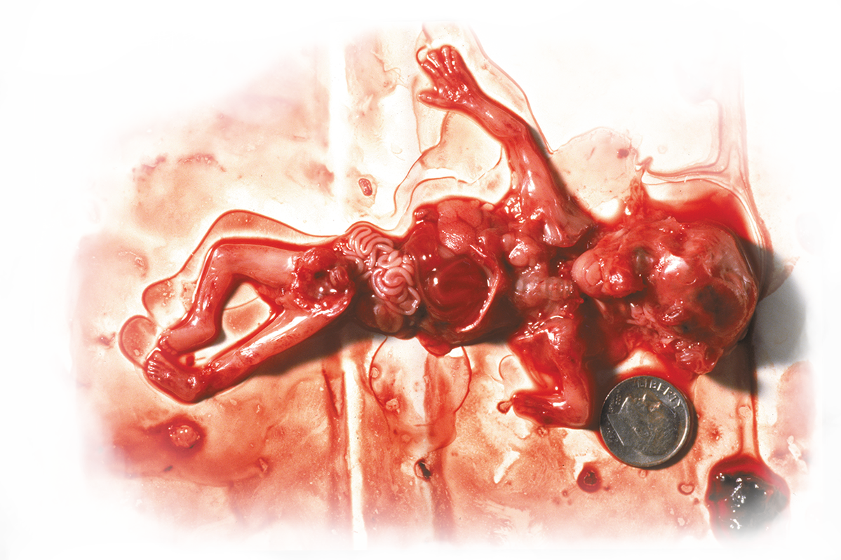 However You Do Have A Right To Stop Having Unproctected - Not Your Body Abortion Meme (1199x799), Png Download