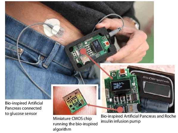 The Bio-inspired Artificial Pancreas - Electronic Component (661x496), Png Download