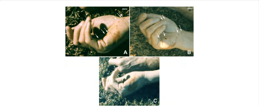 The Right Hand Of The Victim From Death Scene Photographs - Ring (850x348), Png Download