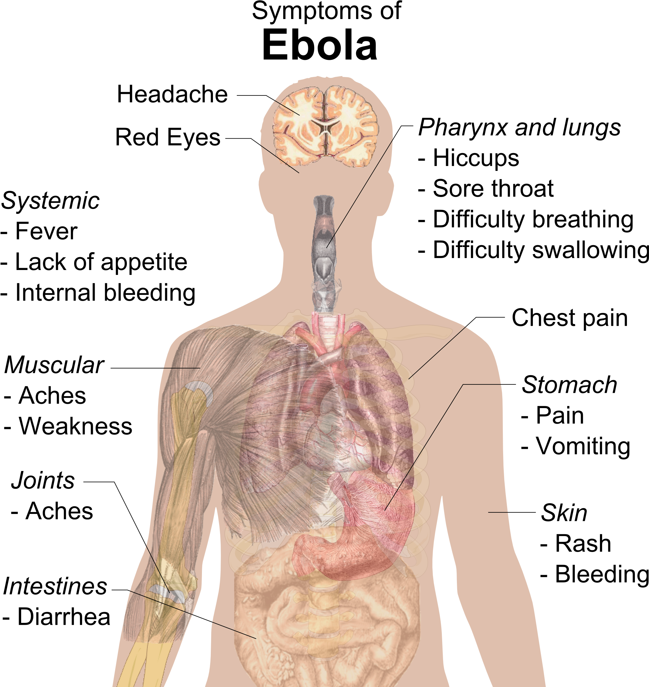 Symptoms Of Ebola - Ebola Symptoms In Spanish (2234x2256), Png Download
