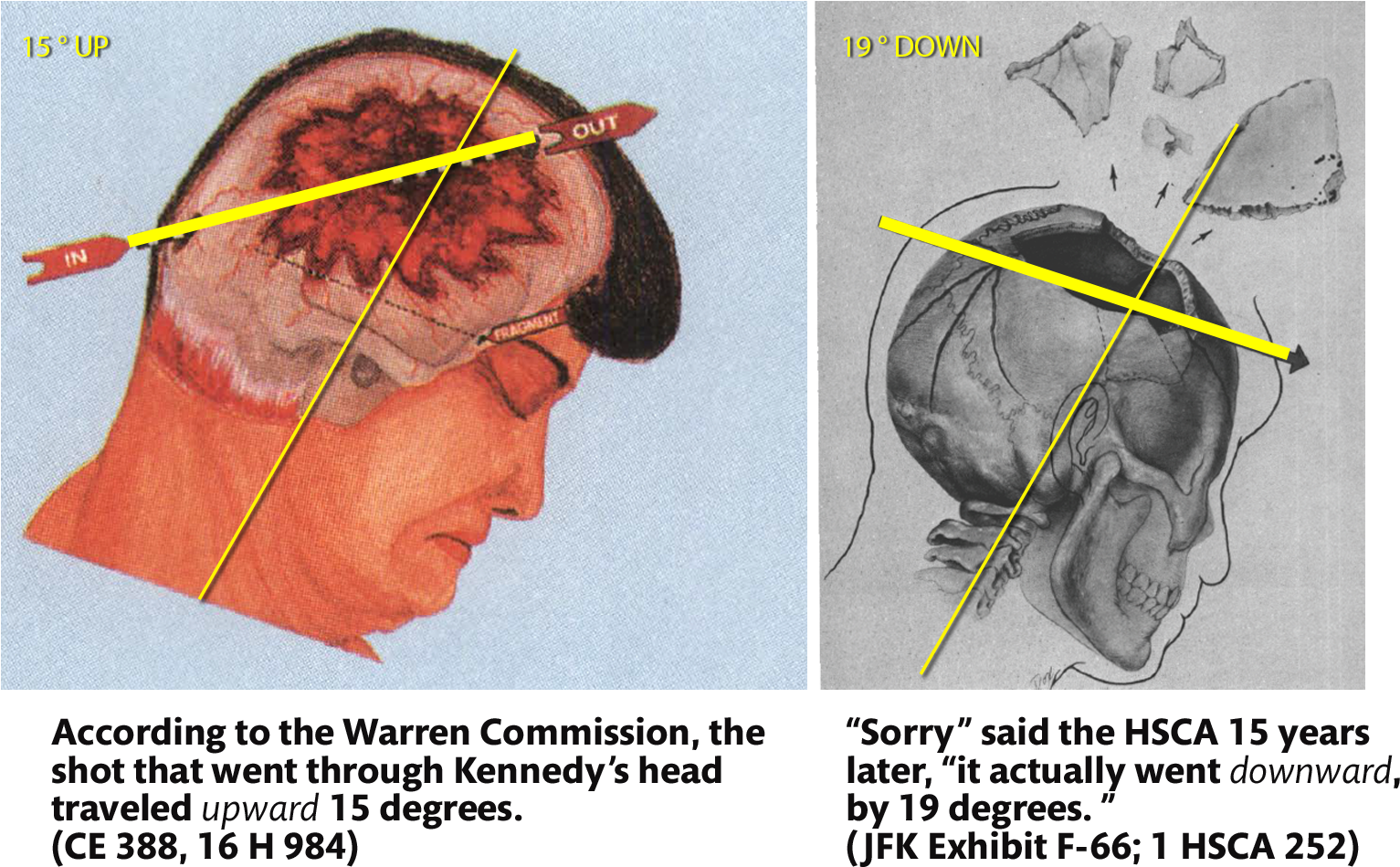 John F Kennedy Autopsy (1600x1000), Png Download