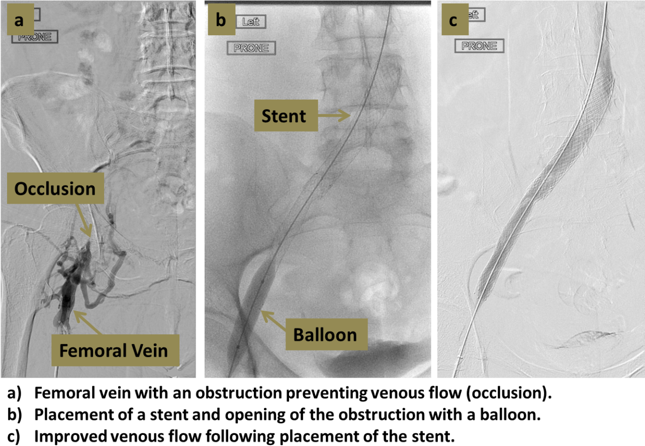 Vein (1292x910), Png Download