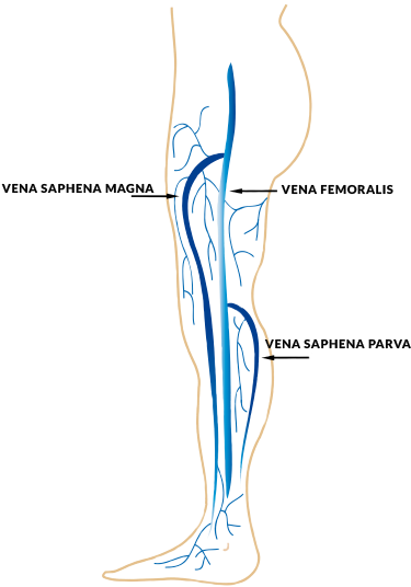 It Is Estimated That 35-60 % Of The Population Suffer - Saphena Magna Vein (376x593), Png Download