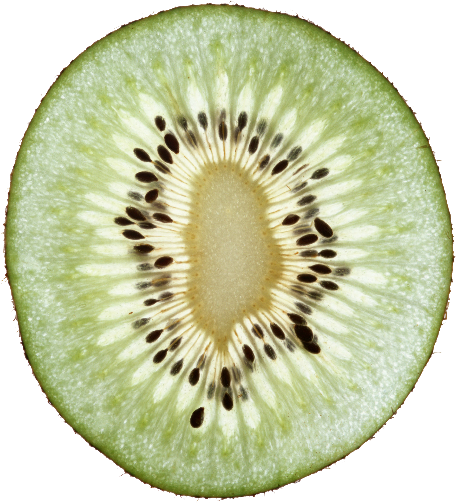 Go To Image - Kiwi Head Png (1553x1705), Png Download