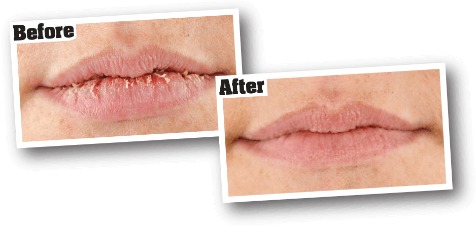 For Best Results - O Keefe Lip Repair (1000x500), Png Download