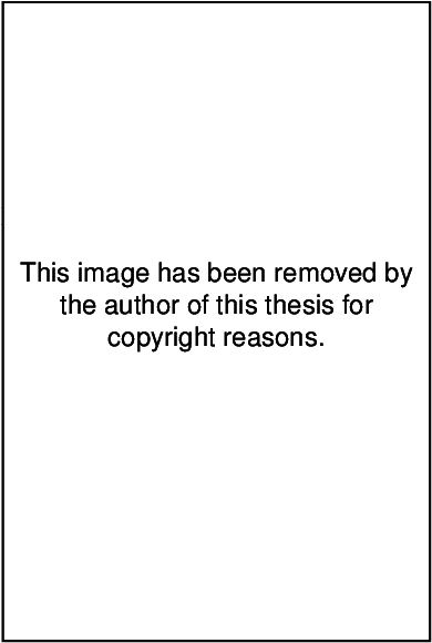 Metal Frame And Pelvic Restraint Device - Bitung (476x589), Png Download