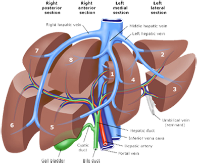 Pld Liver Resection Polycystic Liver Disease Adpld - Liver Lobes Anatomy (400x364), Png Download