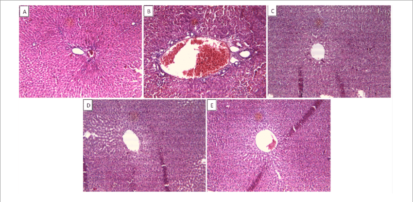 Effect Of Drug Treatment On Liver Histopathology Of - Liver (850x415), Png Download