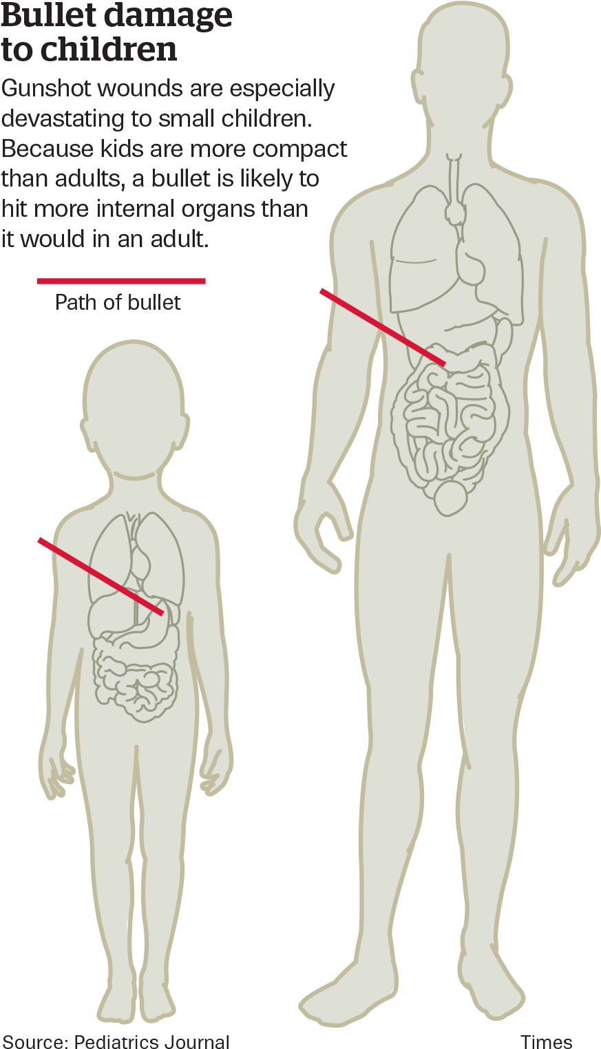 Gunshot Children With Gunshot Wounds Free Transparent PNG Download