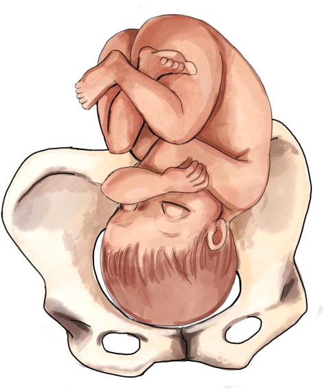 The Ultimate Guide To Baby Position In The Womb - 3rd Trimester Baby Positions (500x647), Png Download