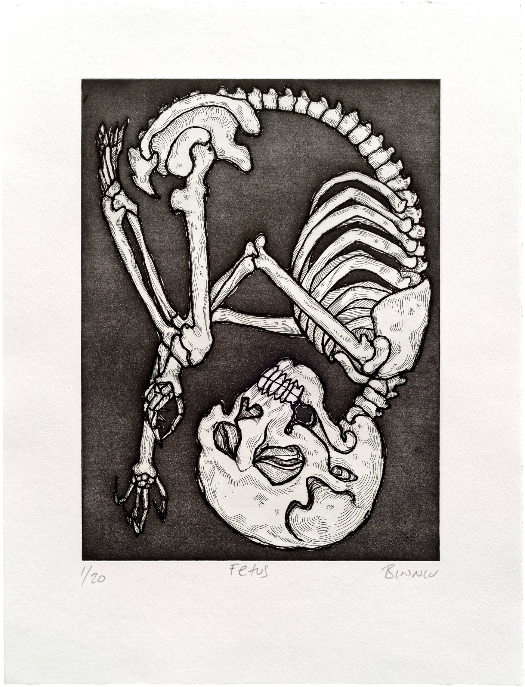 Fetus (2304x2304), Png Download
