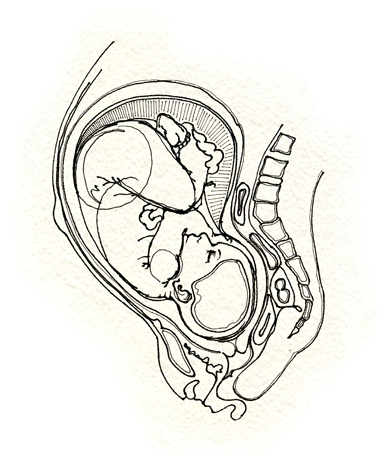 Fetus - Sketch (400x476), Png Download