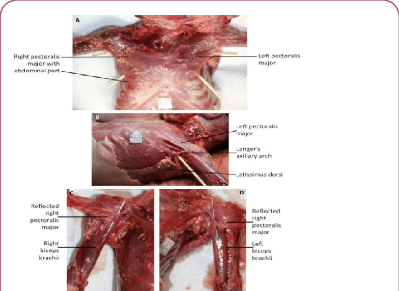 Anterior View Of The Chest Of Female 33 Week Old Fetus - Red Meat (784x572), Png Download