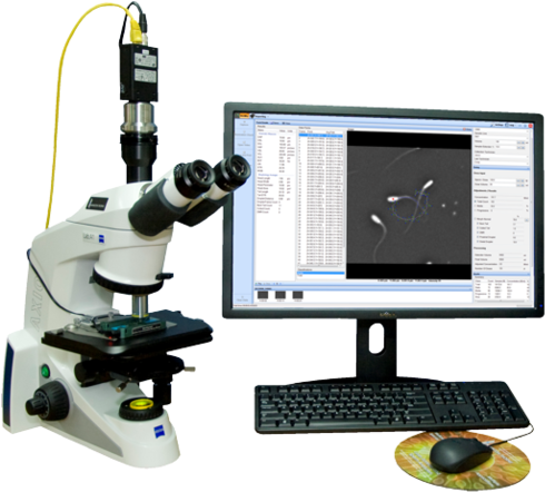 Casa Semen Analyzer - Casa Ceros Ivos Ii (500x450), Png Download