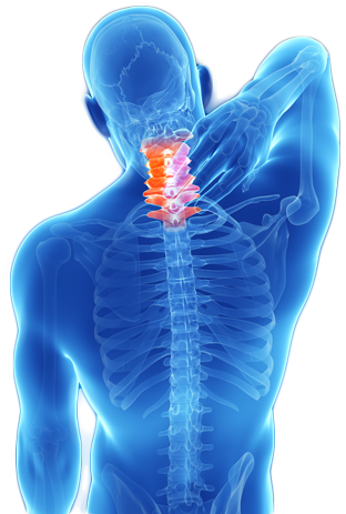 Treatment Neck Pain - Cure For Neck Pain (396x475), Png Download