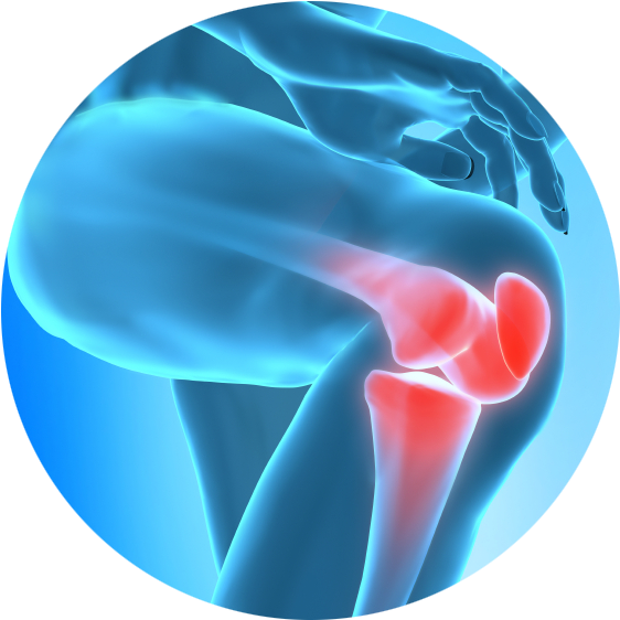 Chronic Joint Pain Slowing You Down Learn How Regenerative - Knee Pain In Png (586x611), Png Download