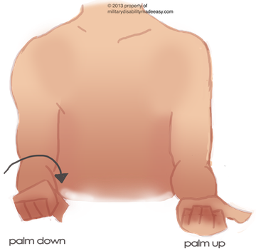 Upper Nerve 21 - Result Of Lesion Of Musculocutaneous Nerve (360x352), Png Download