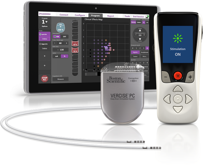 Vercise™ Pc System - Deep Brain Stimulation (960x720), Png Download