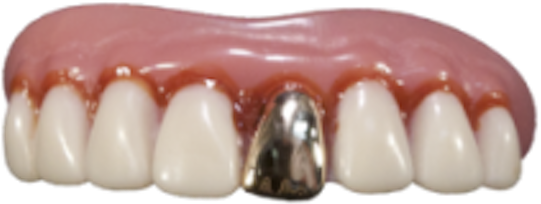 The Original Billy-bob Full Grill Gold Tooth - False Gold Teeth (640x297), Png Download