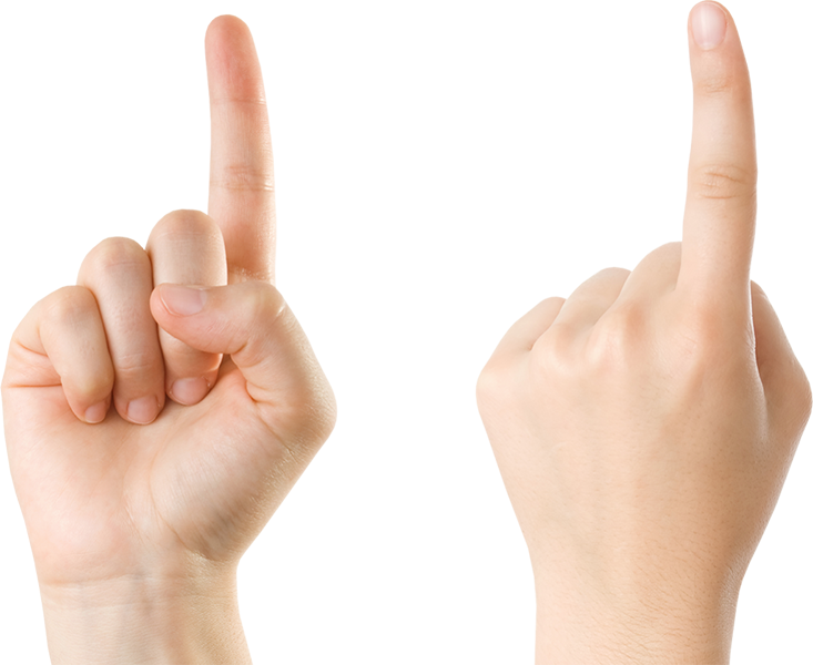 Trigger Finger - Überbein Finger (733x600), Png Download