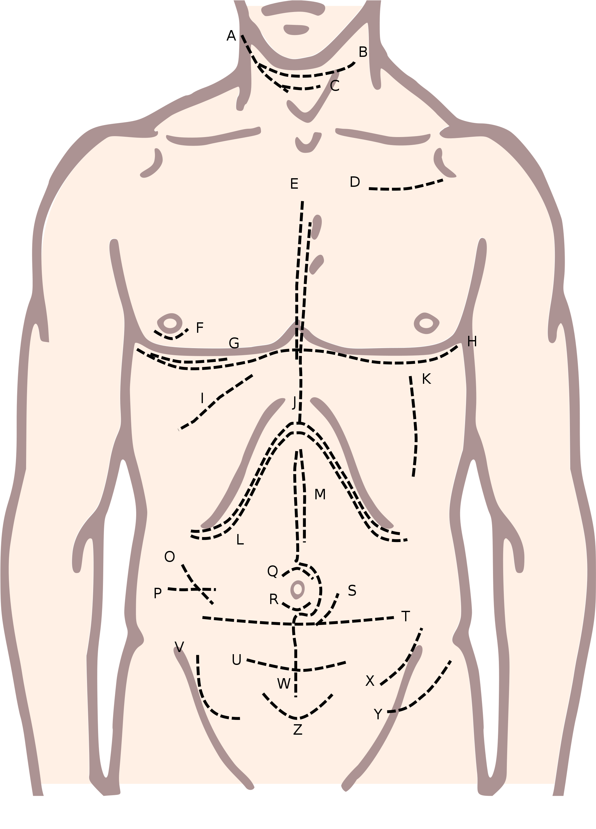 Download Anatomy[edit] Mcevedy Incision PNG Image with No Background