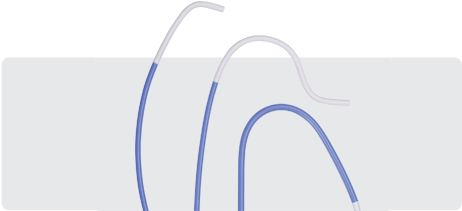 Cardiac Intervention - Cardiology (461x282), Png Download