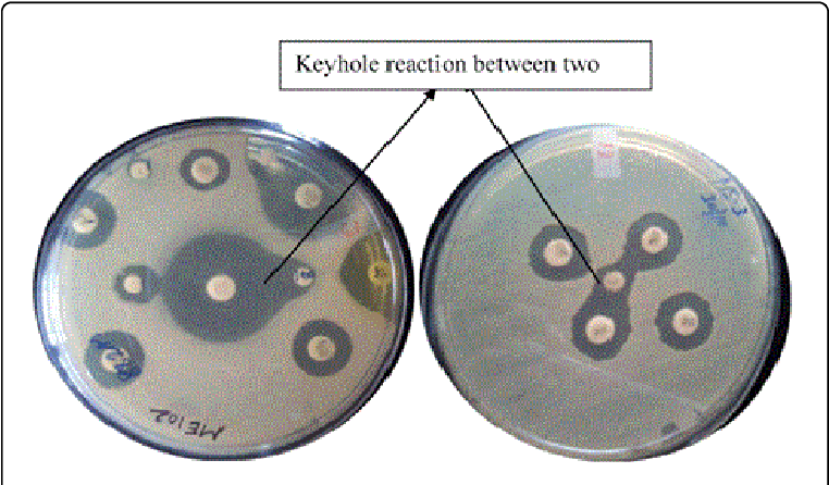 Synergy Between Two Antimicrobials Indicated By Key-hole - Circle (769x449), Png Download