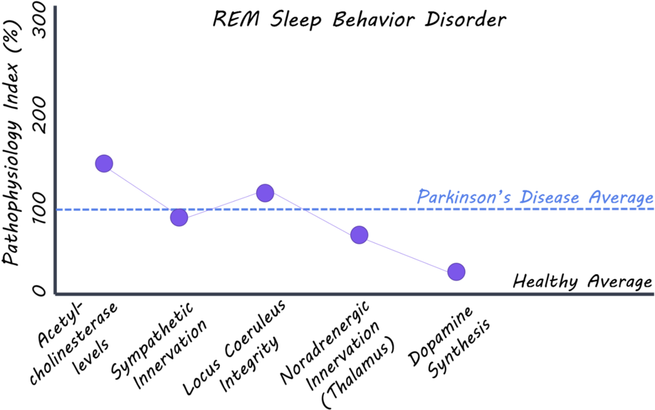 Remsleep1800 - Portable Network Graphics (1000x653), Png Download