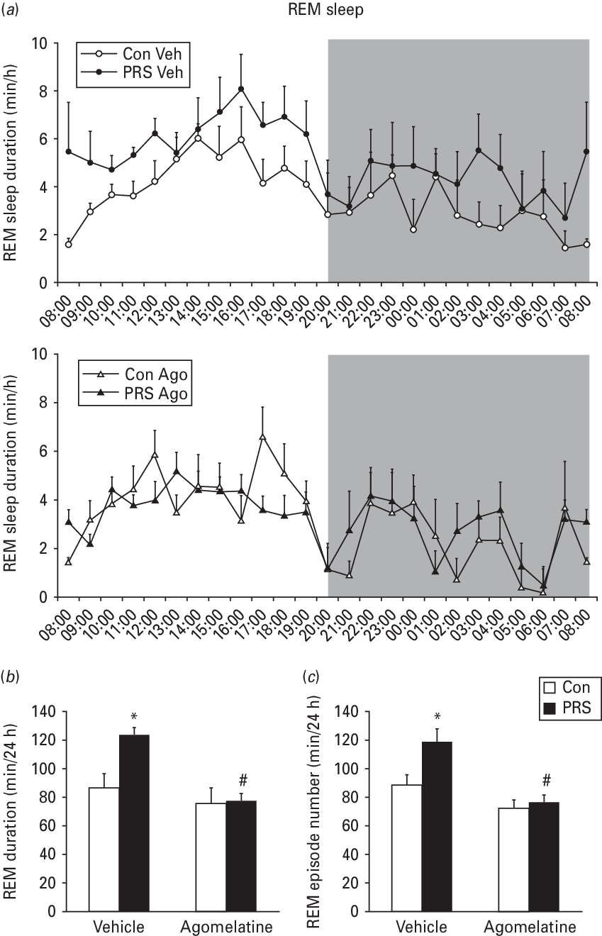 Rapid Eye Movement Sleep Profile Over 24 H - Diagram (849x1320), Png Download