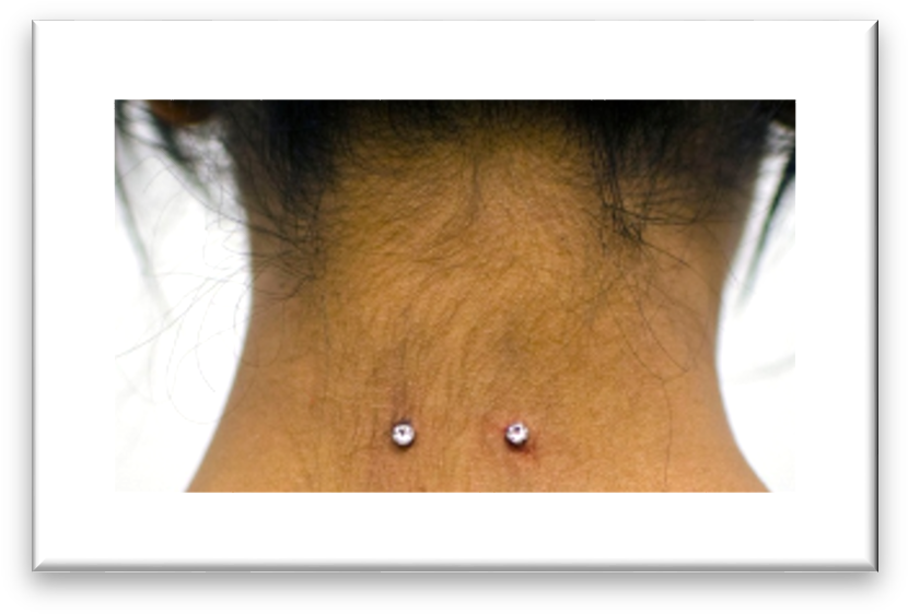 Examples Of Unacceptable Piercings - Throat (844x576), Png Download