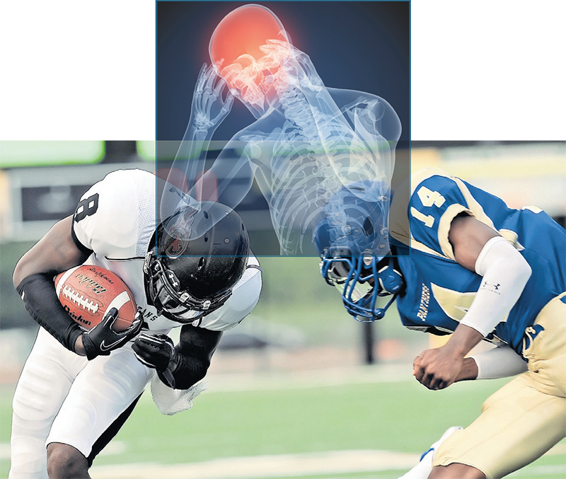 Concussion - Football Sport Related Concussion In The Young Athlete (800x677), Png Download