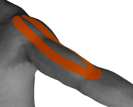 2011년 10월 20일 목요일 - Taping Biceps (447x359), Png Download